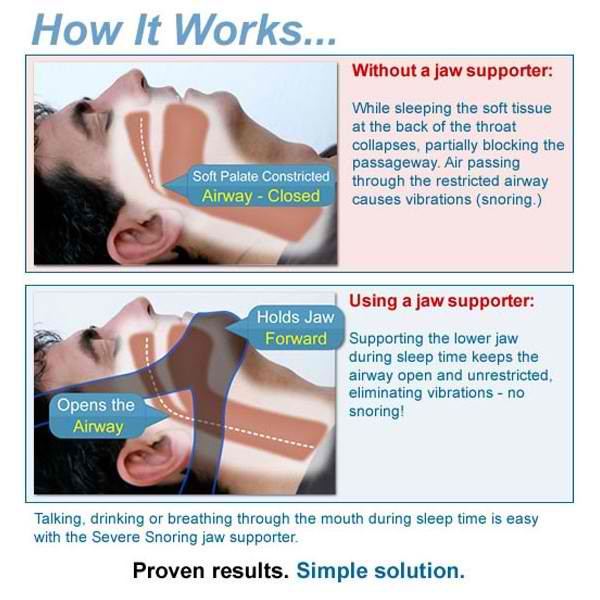 my snores my snoring solution chin my snores my snoring solution chin