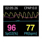 BMC SleepView Sleep Screener Pulse Oximetry with Airflow Machine